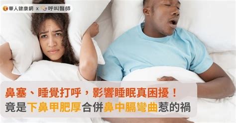 兩頭人|兩頭人的困擾：睡覺很麻煩